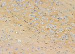 MAGEE2 Polyclonal Antibody