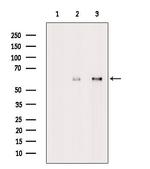 MAGEE2 Antibody in Western Blot (WB)