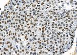 NDNL2 Antibody in Immunohistochemistry (Paraffin) (IHC (P))