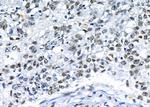 NDNL2 Polyclonal Antibody