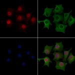 ATOH8 Polyclonal Antibody