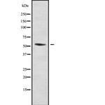 DMRTA1 Polyclonal Antibody