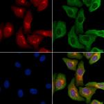 LARP2 Polyclonal Antibody