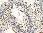 Cytomegalovirus UL97 Antibody in Immunohistochemistry (Paraffin) (IHC (P))