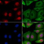 ZNF227 Polyclonal Antibody