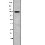 DMRTC2 Polyclonal Antibody