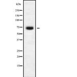KLHL36 Antibody in Western Blot (WB)