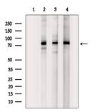 ZNF441 Polyclonal Antibody