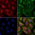 PPP1R9B Polyclonal Antibody