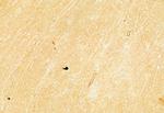 PPP1R9B Antibody in Immunohistochemistry (Paraffin) (IHC (P))