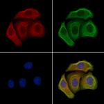 MYCBP Polyclonal Antibody