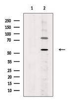 ZNF577 Antibody in Western Blot (WB)