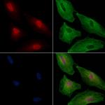 HIPK3 Polyclonal Antibody