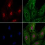NOLA1 Polyclonal Antibody