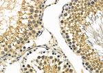 JDP2 Polyclonal Antibody