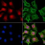 CDY1 Polyclonal Antibody