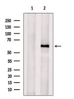 CYP11B2 Polyclonal Antibody