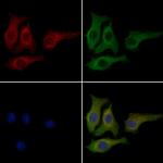 CCBE1 Polyclonal Antibody
