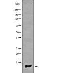 COX7A1 Antibody in Western Blot (WB)