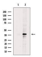 DNAJB2 Polyclonal Antibody