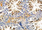 COL26A1 Antibody in Immunohistochemistry (Paraffin) (IHC (P))