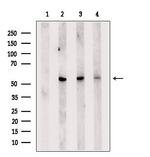 COL26A1 Antibody in Western Blot (WB)