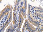 IFNLR1 Polyclonal Antibody