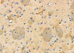 IGFL2 Antibody in Immunohistochemistry (Paraffin) (IHC (P))