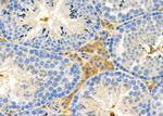 IGFL2 Antibody in Immunohistochemistry (Paraffin) (IHC (P))