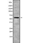 CDC14B/CDC14C Antibody in Western Blot (WB)