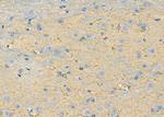 CYP4Z1/CYP4Z2P Antibody in Immunohistochemistry (Paraffin) (IHC (P))