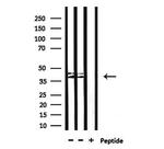 CYP4Z1/CYP4Z2P Antibody in Western Blot (WB)