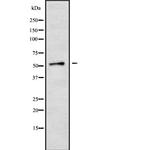 CYP2A6/CYP2A7/CYP2A13 Polyclonal Antibody