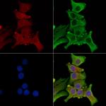 NPR1 Polyclonal Antibody