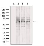 CAMKK1 Polyclonal Antibody