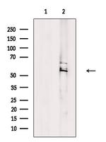 CAMKK1 Antibody in Western Blot (WB)