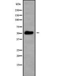 CK1 gamma-3 Antibody in Western Blot (WB)