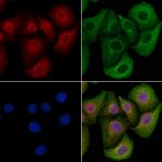 DYRK2 Polyclonal Antibody