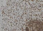 DYRK2 Antibody in Immunohistochemistry (Paraffin) (IHC (P))