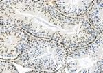 PCTAIRE2 Antibody in Immunohistochemistry (Paraffin) (IHC (P))
