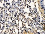 Apolipoprotein C1 Antibody in Immunohistochemistry (Paraffin) (IHC (P))