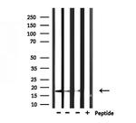 KLRC2/KLRC4 Polyclonal Antibody