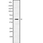 RGMB Antibody in Western Blot (WB)