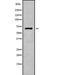 PODN Polyclonal Antibody