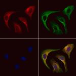 LINGO2 Polyclonal Antibody