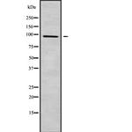 TRPV3 Antibody in Western Blot (WB)