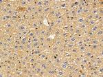 FDCSP Antibody in Immunohistochemistry (Paraffin) (IHC (P))