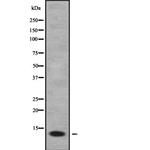 FDCSP Antibody in Western Blot (WB)