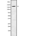 LTBP1 Polyclonal Antibody