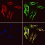 SCGN Polyclonal Antibody